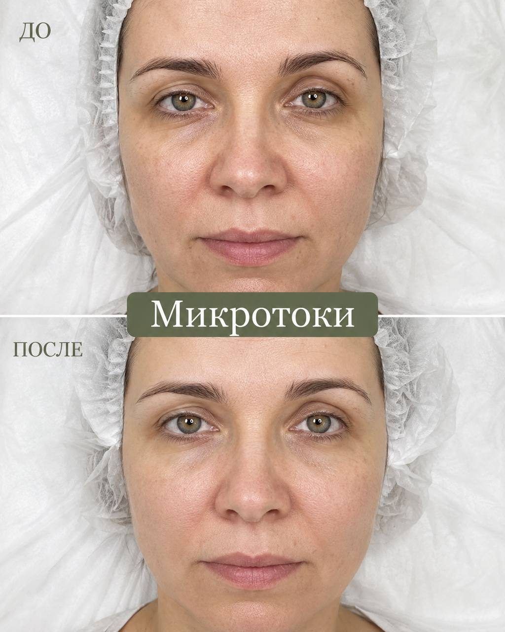 Микротоки — до и после, в Клинцах